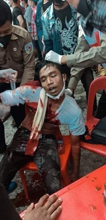 Armed police and military forces shot people and 5 people died at once in Hledan Yangon,this morning. How many dead bodies are required more for international communities to take action on brutal JUNTA?
#Feb28Coup #WhatsHappeningInMyanmar #MilkTeaAliance