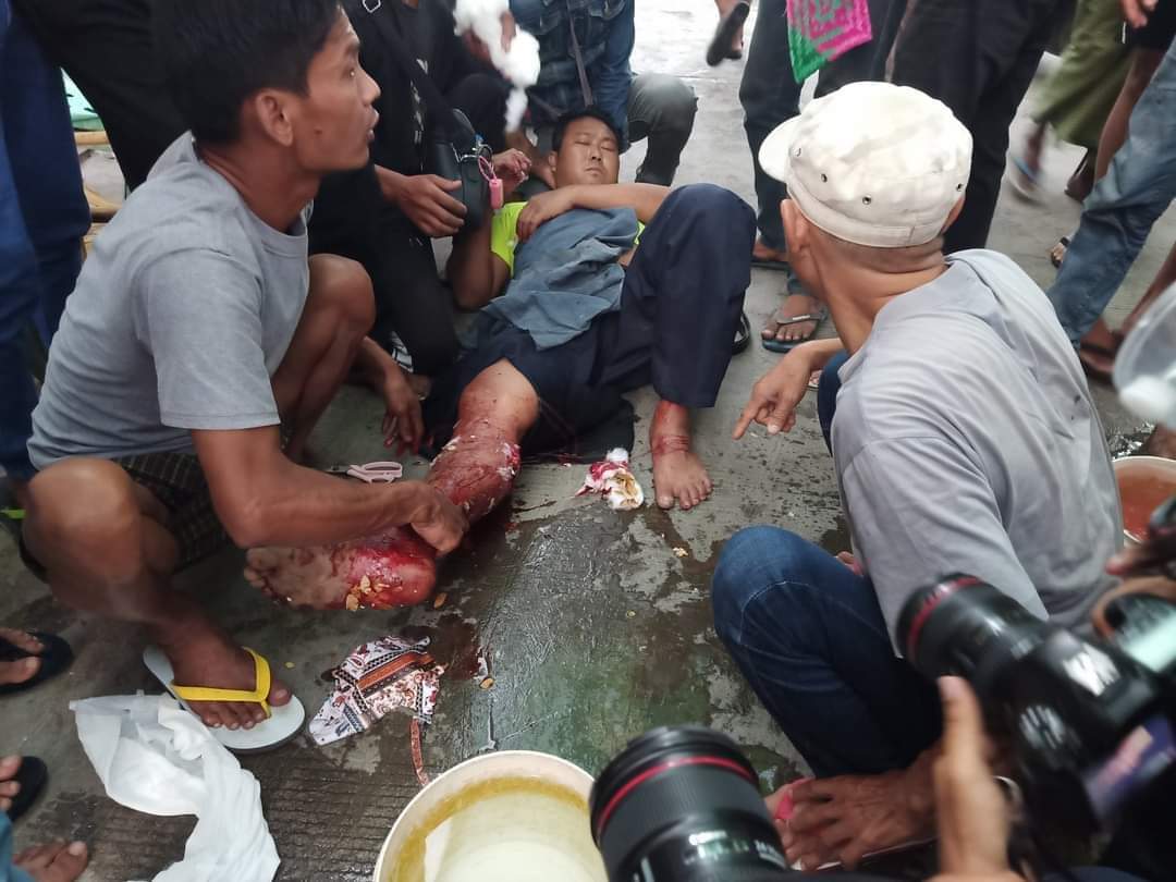 SintSarah9's tweet photo. Riot police shot the civilians passing by in MANDALAY this evening. 2 were shot to the legs and one female shot to the head &amp; killed on the spot.
TW//blood
#Feb28Coup
#WhatsHappeningInMyanmar
#MilkTeaAlliance
@freya_cole @KenRoth @UNinMyanmar  @YourAnonCentral @RapporteurUn https://t.co/MGBjTyaYhJ