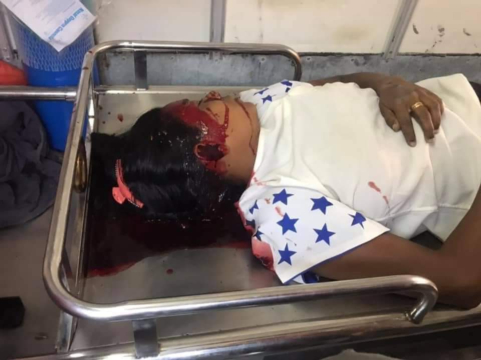 SintSarah9's tweet photo. @YourAnonCentral Riot police shot the civilians passing by in MANDALAY this evening. 2 were shot to the legs and one female shot to the head &amp; killed on the spot.
TW//blood
#Feb28Coup
#WhatsHappeningInMyanmar
#MilkTeaAlliance
@freya_cole @KenRoth @UNinMyanmar  @YourAnonCentral @RapporteurUn https://t.co/U214wsggrq