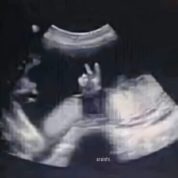 อซทตอนอยู่ในครรภ์      และนี่คือม้าค