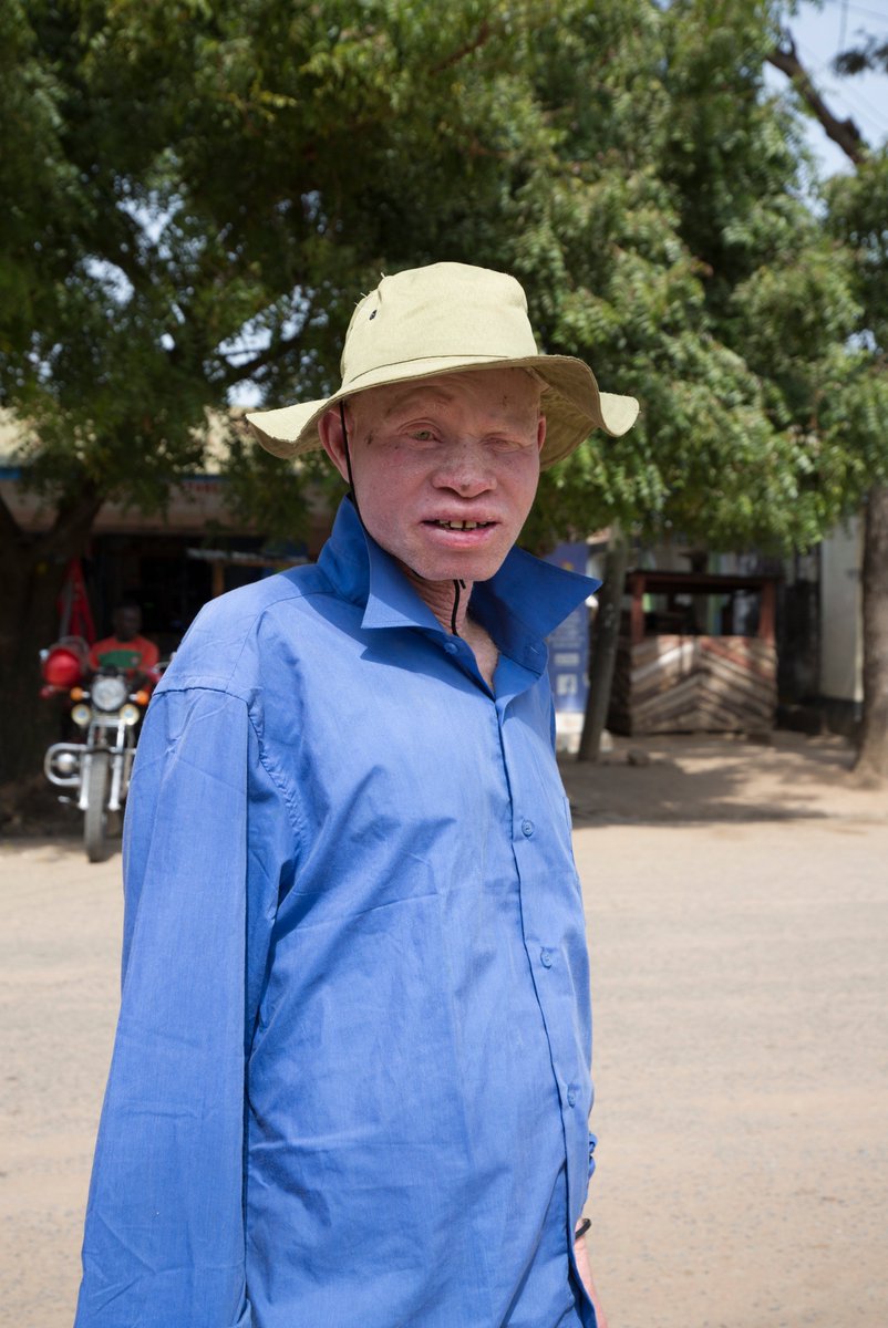 Today on #ZeroDiscriminationDay, we affirm the right of every person with albinism to live free of stigma and persecution. With continued perseverance from us all, we can build a future for people with #albinism where every day becomes Zero Discrimination Day 📸 <a href="/imogenfreeland/">Imogen Freeland</a>