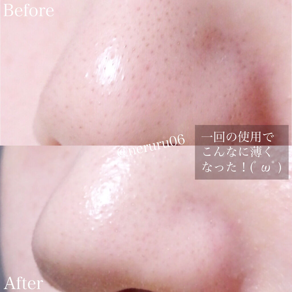 Uzivatel Lips リップス Na Twitteru Lips4択アンケート 結果 毛穴ケア 無印良品 ホホバオイル 50ml 4 Tax 角質でザラザラしていたのも 一体どこへ行ったのかつるっつるになりました 本当に効果があってびっくりしてるので 悩んでいる方は是非٩ W