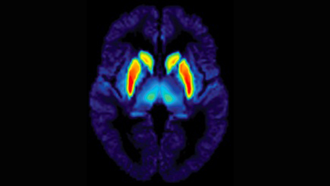 Brain1878 tweet picture