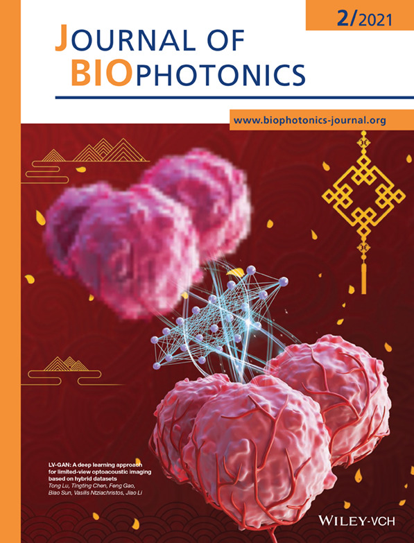 MunichImaging's tweet photo. February front cover for Tong Lu, Jiao Li and @MunichImaging director Vasilis @ntziachristos for „LV‐GAN: A #deeplearning approach for #limitedview #optoacoustic #imaging based on hybrid datasets” first published 10/2020 in @jbiophotonics
#photoacoustic
https://t.co/NS1HoVgivu https://t.co/ObqpBMeAn2