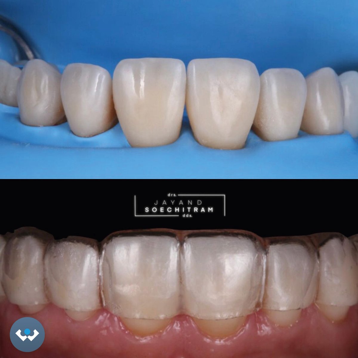 Excent Tandtechniek tweet media