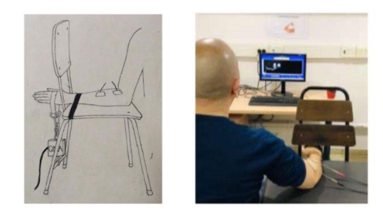 ArtifOrgans's tweet image. #EditorsPick | Effects of #Interphase interval during #Neuromuscular #Electrical #Stimulation of the wrist #Extensors with maximally tolerated #Current #Intensity 👇
bit.ly/3aYycrw
@UofHaifa 🇮🇱
#Muscle #MuscleForce #NMES #EditorsChoice