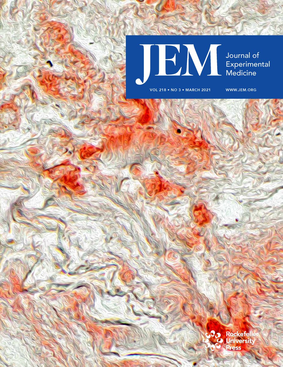 Rockefeller U. Press (@rockupress) on Twitter photo On the cover of <a href="/JExpMed/">Journal of Experimental Medicine</a> March Issue: an immunohistochemical image shows NLRP3 expression in the lungs of #COVID19 patients. <a href="/tamrodrigues1/">Tamara Rodrigues</a> et al. describe the activation of #inflammasomes in COVID-19 (bit.ly/37LTplF). Read the JEM March Issue: bit.ly/3aQkF5n On the cover of <a href="/JExpMed/">Journal of Experimental Medicine</a> March Issue: an immunohistochemical image shows NLRP3 expression in the lungs of #COVID19 patients. <a href="/tamrodrigues1/">Tamara Rodrigues</a> et al. describe the activation of #inflammasomes in COVID-19 (bit.ly/37LTplF). Read the JEM March Issue: bit.ly/3aQkF5n