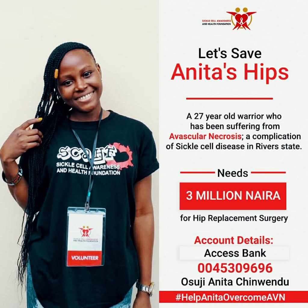 beebeeaana's tweet photo. Good evening everyone, I want to talk about a friend and a follow volunteer Anita who has AVN and would be needing two hips replacement surgery so she can walk again... AVN is a complication that affect people leaving with SCD... 
please Donate and Also help Retweet 🙏🏿🙏🏿🙏🏿🙏🏿 https://t.co/aKaHyaiqWa