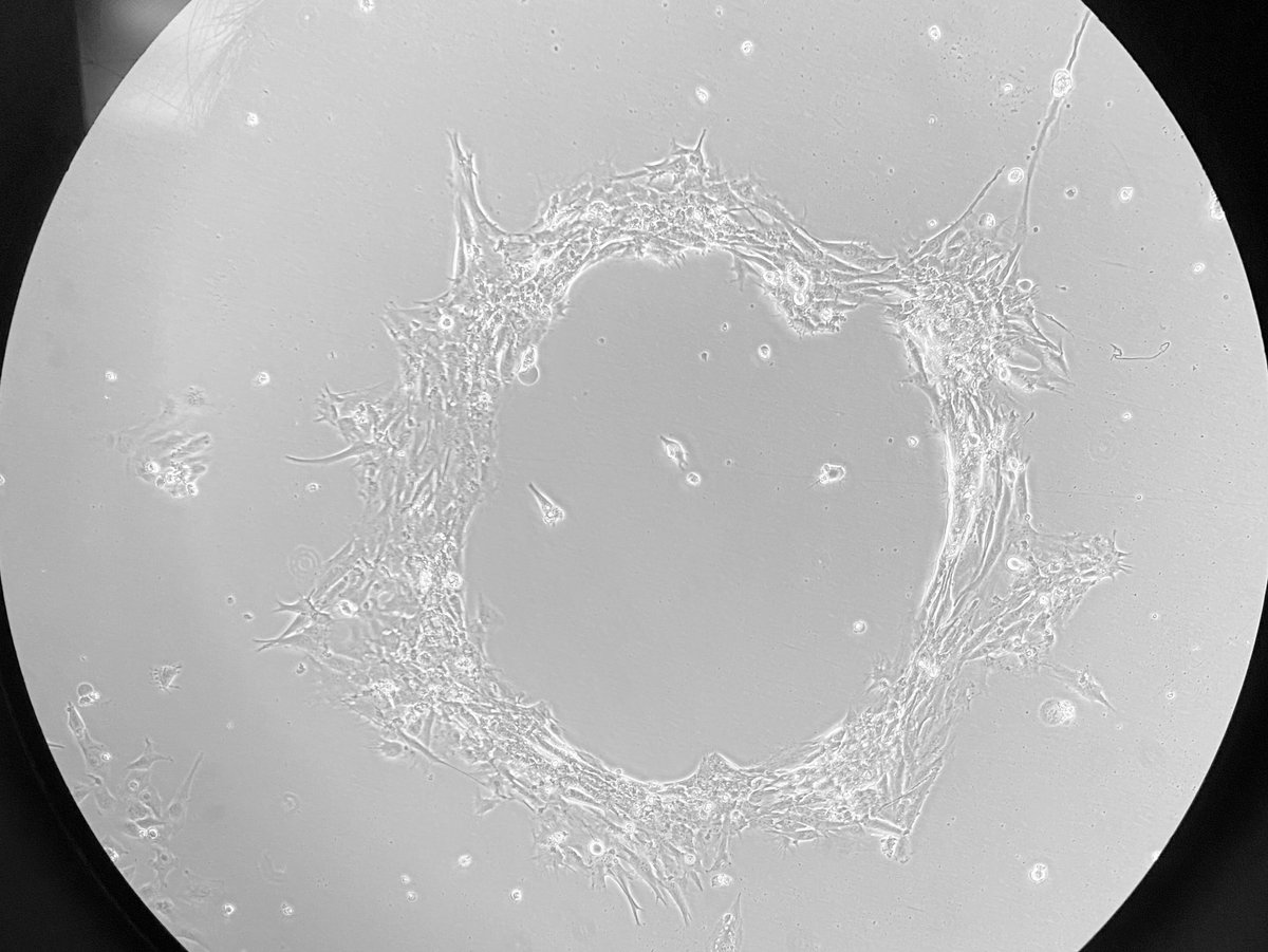 paosmeade's tweet photo. These GBM cells never fail to amaze me! #UnderMyMicroscope series. https://t.co/B1mw1dckhY