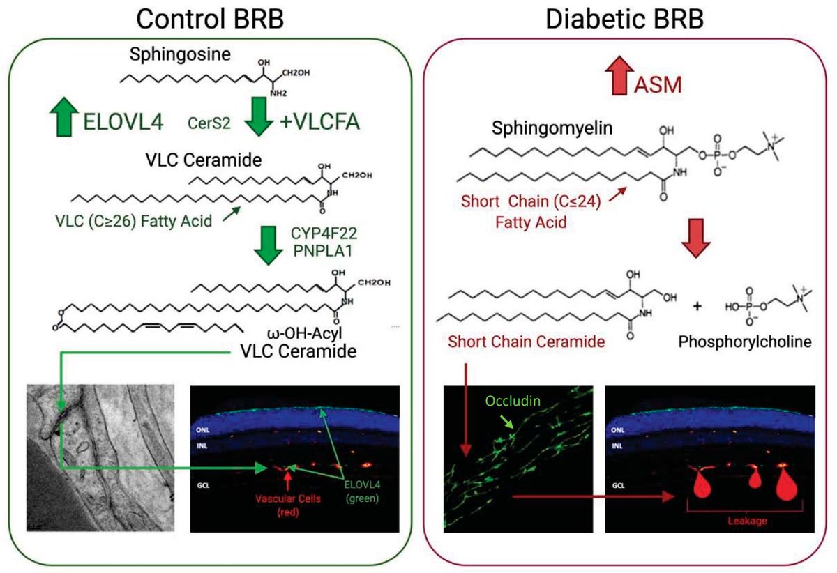 jlipidres's tweet photo. Paper in press: "Lipid metabolism dysregulation in diabetic retinopathy" – #DiabeticRetinopathy #Ceramides #Cholesterol #Omega3 #FattyAcids

https://t.co/DRIiC1RkSd
@michiganstateu https://t.co/pYotm9xRj7
