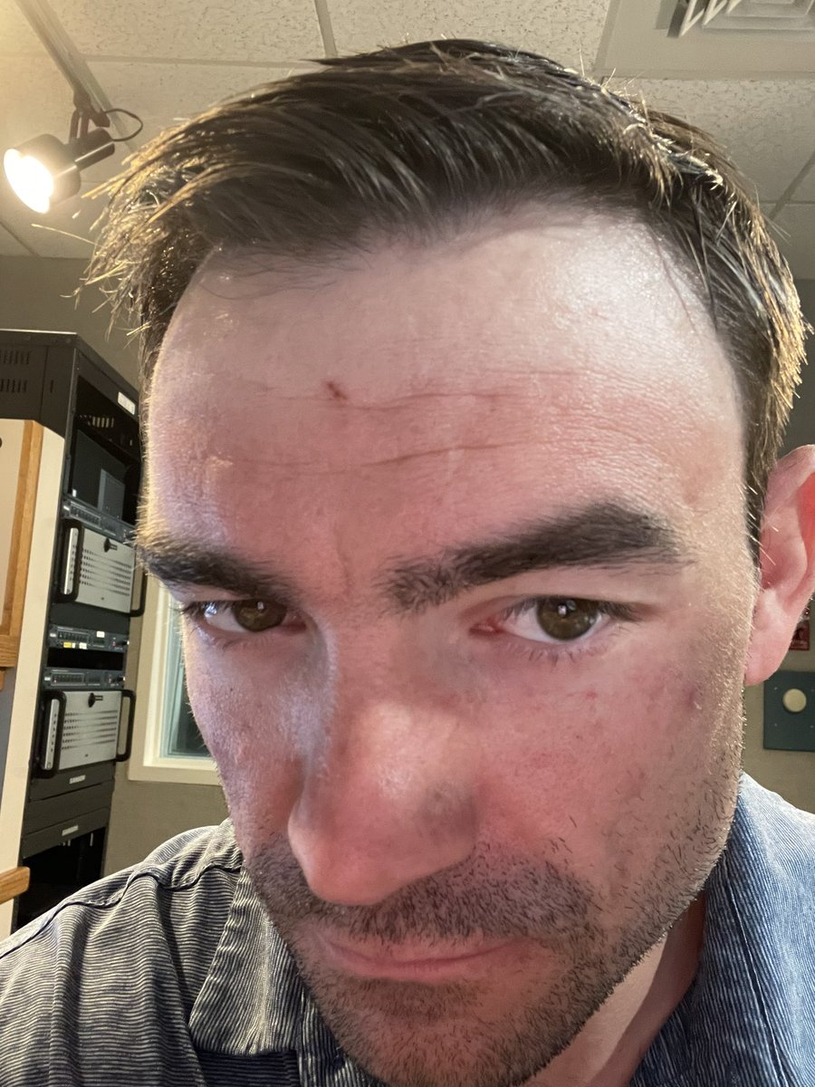 GetNickG's tweet photo. Can you tell I went to the beach? It’s #TanLineSZN https://t.co/7PpbtEo61F