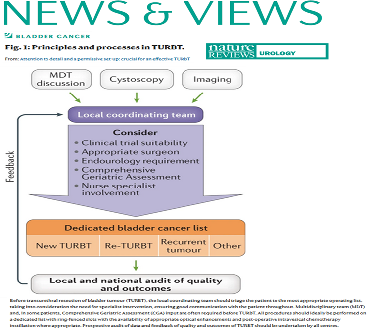 NatRevUrol's tweet photo. #NEWinNRU A News&Views from @ParamMariappan on how attention to detail and a permissive set-up are crucial for an effective TURBT for #BladderCancer https://t.co/biTQU68OsK https://t.co/CD8dChV6OR