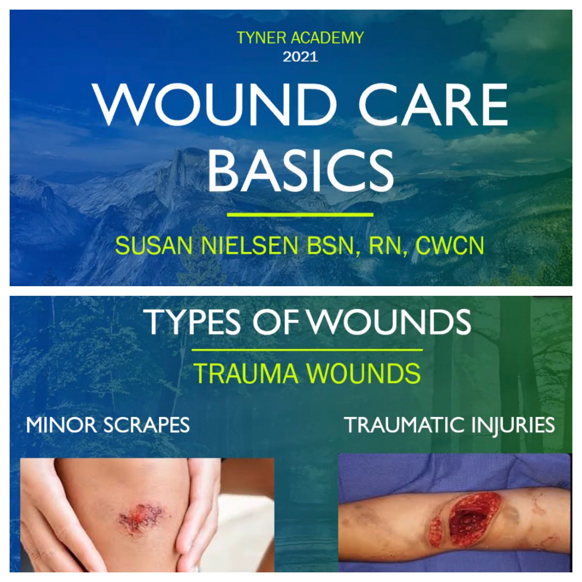 TA_FutureReady's tweet photo. The Health Sciences @HCSfutureready Institute kicked off an integrated PBL with the Regional Director of Advanced Wound Care, Susan Nielsen of Parkridge @HCAhealthcare. She provided an overview of wounds, punctures, &amp; treatments as students dive into their studies #HCSFutureReady https://t.co/eUWq6YssXZ