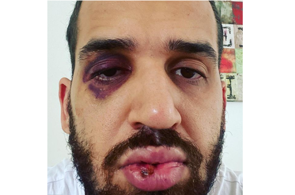 g1parana's tweet photo. Médico é agredido por familiar após alertar sobre riscos da Covid-19, no Paraná: 'Dói, mas sinto que estou do lado que zela pela vida'
https://t.co/DbYFcxu5BN #G1 #G1PR https://t.co/R7hPvayz68
