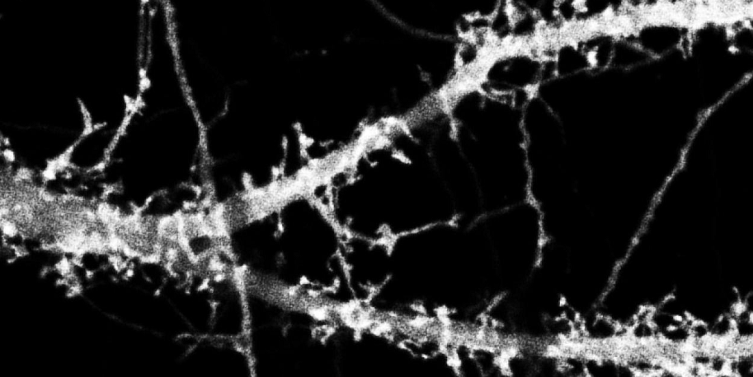 scisignal's tweet photo. A new study in mice suggests that therapies that interfere with the #ghrelin receptor GHS-R1a may disrupt spatial and recognition memory and lead to cognitive side effects. #MechanismMatters https://t.co/ePE5C1SnKo https://t.co/UcewhlJ1bz