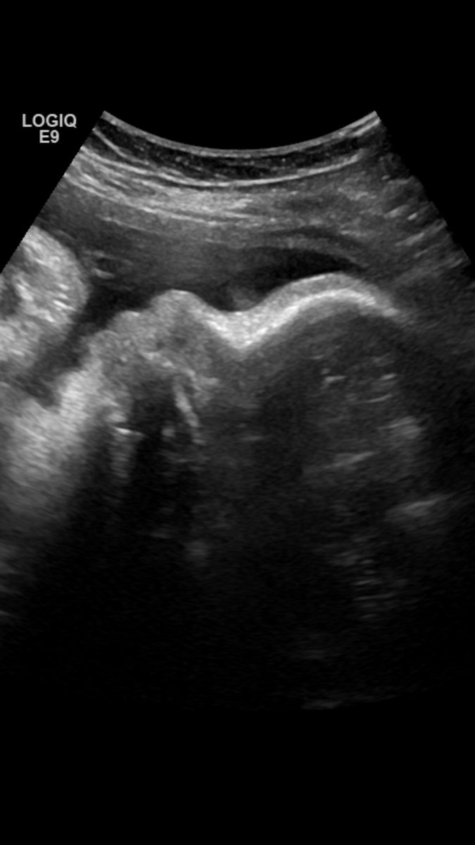 mads185's tweet photo. It’s our due date month 💗 https://t.co/LzzfDZ5Pvh