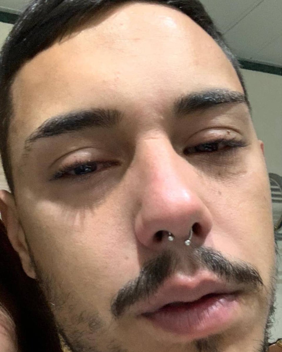 alvfdez15's tweet photo. ESTOY BUSCANDO A ESTE HIJODPUTA, SI SABES ALGO DE ÉL CONTACTA CONMIGO O LA POLICÍA, JOAQUÍN MUÑOZ MOLINA, 26 AÑOS, LE HA PEGADO UNA PALIZA A MI PRIMA Y CASI LA MATA, LA DEJÓ EN UNA ZANJA ABANDONADA Y X SUERTE RECUPERÓ LA CONSCIENCIA https://t.co/vlfwvW3ret