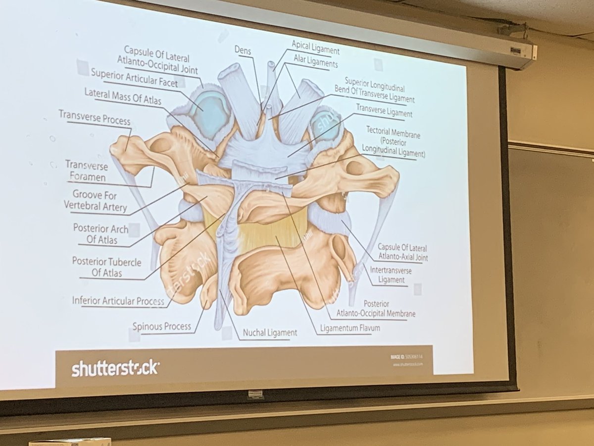 drdennisfiorini's tweet photo. This is the area we are trying to align. #gogoao #complicated #atlasorthogonal #ccj #headaches #neckpain https://t.co/sDnSJyWdhl https://t.co/b2R3hoyjRY
