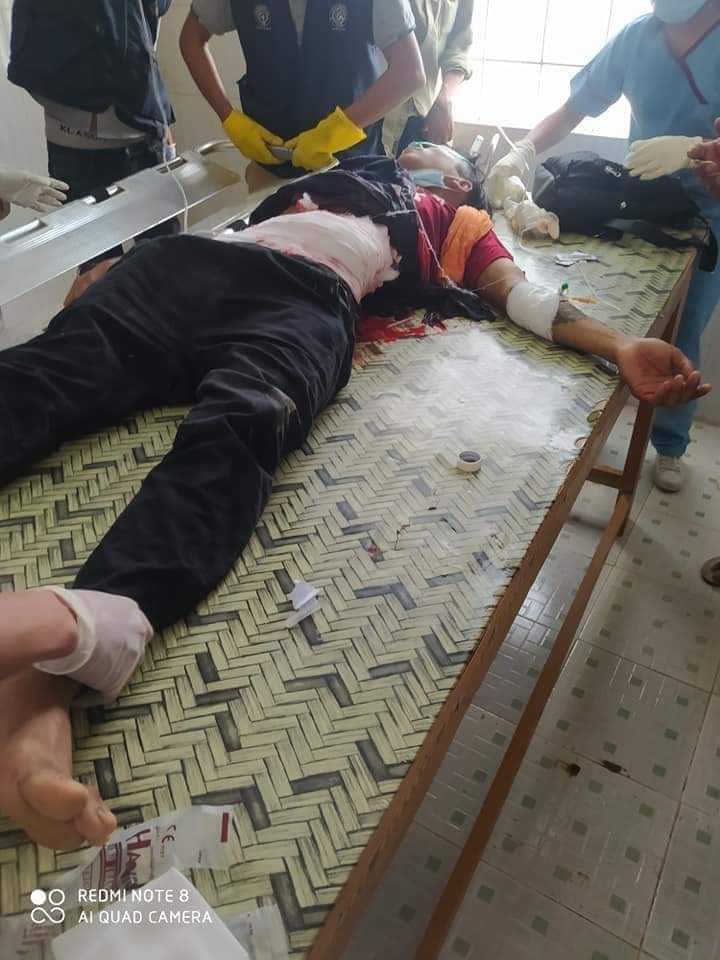 Aaron092754's tweet photo. In Kalae, Burma, a peaceful protester got seriously injured in abdomen and the junta's cops are asking for corpse to take away. 
#Mar2Coup 
#WhatsHapppeningInMyanmar https://t.co/44yRzpkI1K