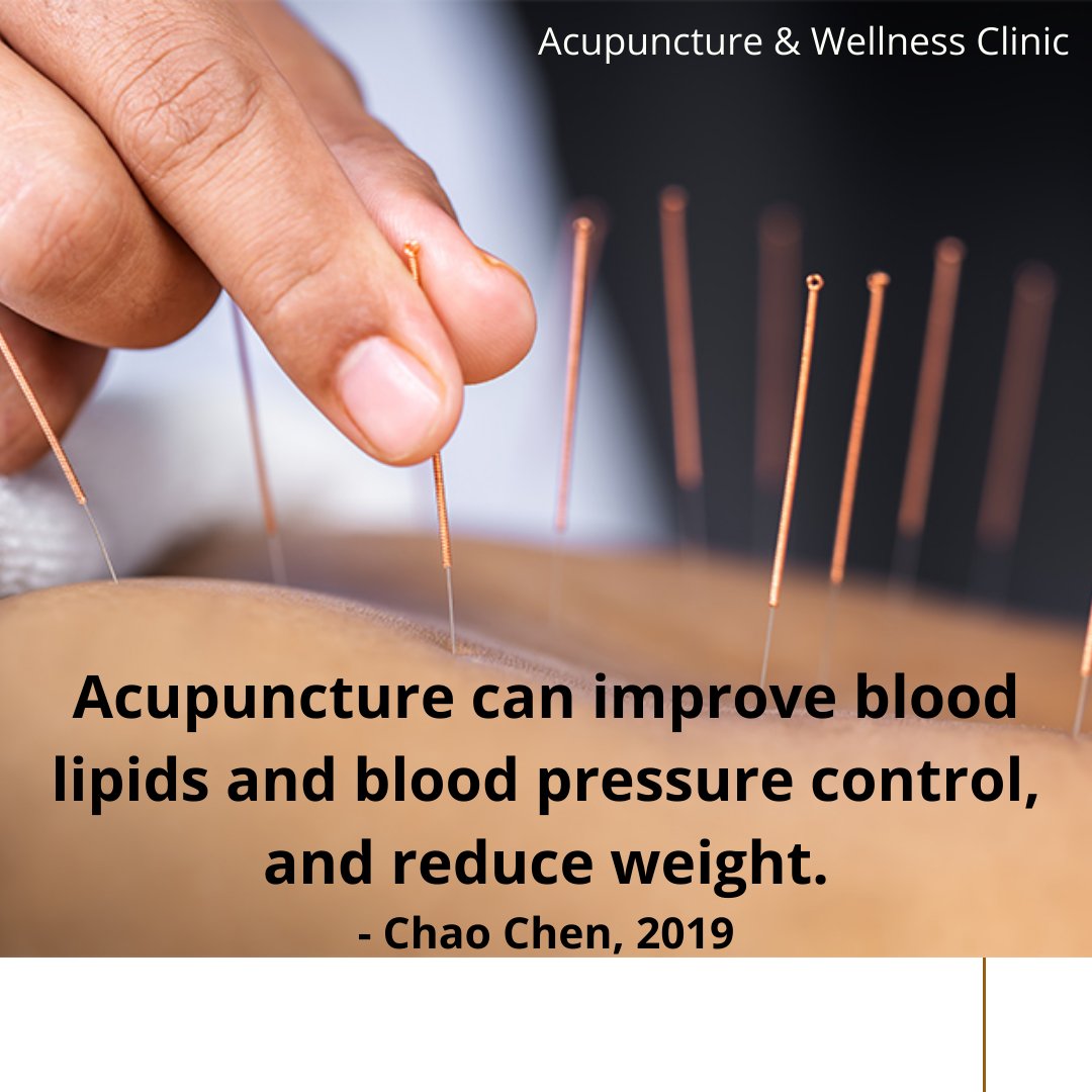 easycure's tweet photo. Manage you cholesterol and High Blood Pressure with Acupuncture and Yoga. 
Research has shown that Acupuncture can balance High blood pressure and help in reducing weight. To know more call us. 
#Pune #punenews #pcmc #yoga #lifestyleblogger #sakalnews #healthcare #COVIDー19 https://t.co/riOstCuXZu