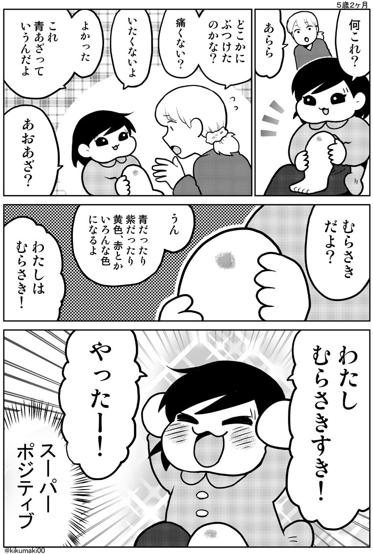 青あざ #育児漫画 #娘が可愛すぎるんじゃ 