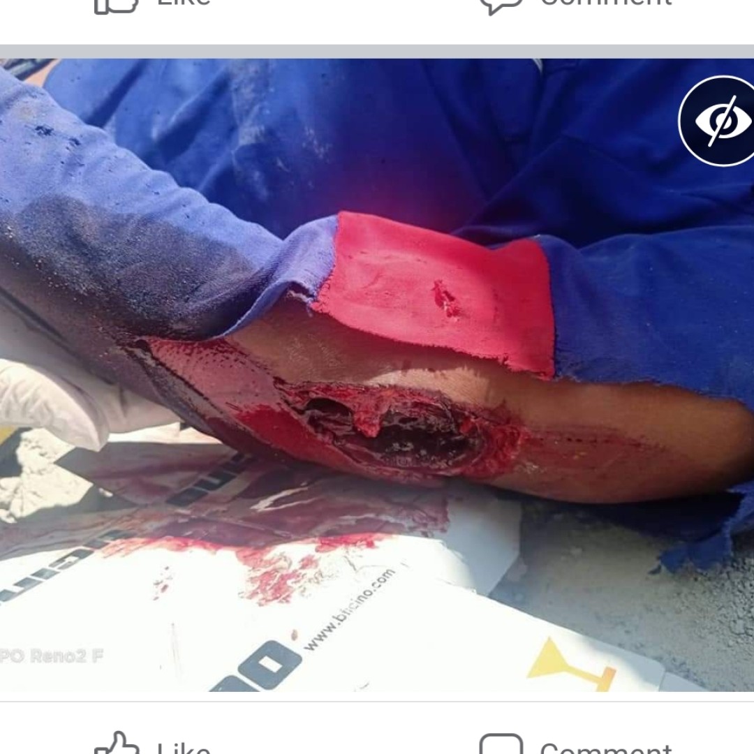 stevekaposi's tweet photo. Worker in #Thailand falls, breaks leg
https://t.co/derrS4OrDt
https://t.co/gINVnYHj1j
#Bangkok #SteveKThailand #TACSThailand #ThailandWatch #DiscoverThailand #Strange #AmazingThailand #FunnyThailand #GruesomeThailand #ThaiSafetyFirst #ThailandFails #ThaiBuildingFails #fails https://t.co/xg9mlAboTy