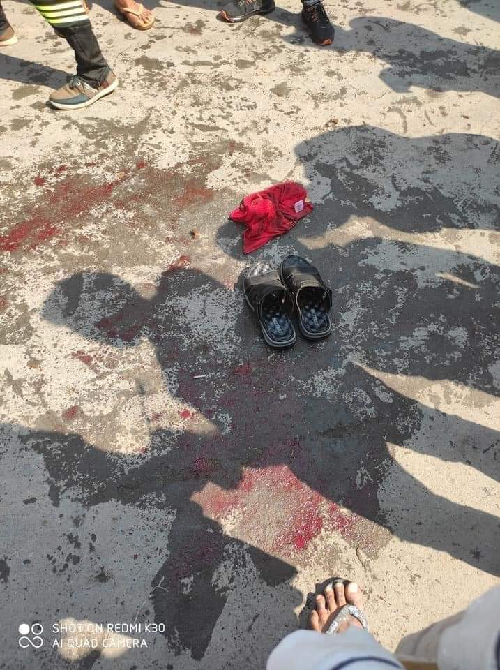 TW//Blood🚨 Kalay, Sagaing Region🚨Terrorists opened fire with live rounds. ONE DIED of a gunshot wound at abdomen. SEVERAL CASUALTIES from gunshots including one to thigh, one to chest in critical condition. #WhatsHapppeningInMyanmar #Mar2Coup