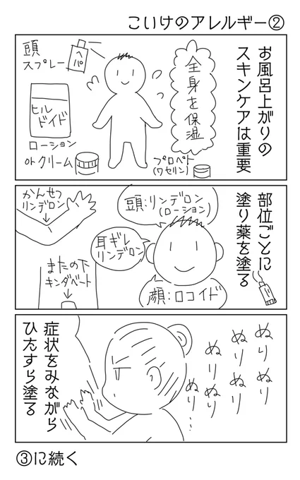 こいけのアレルギー②アトピーっ子だと、ともかく塗るアイテムが多いですよね…。#育児漫画#いけやん漫画 