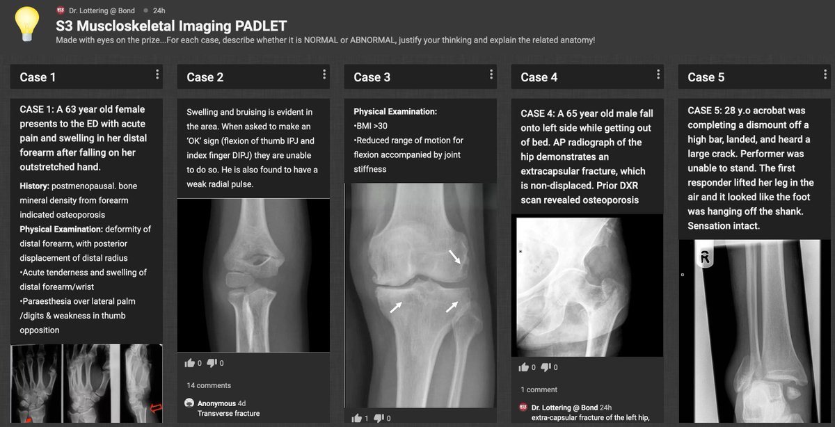 nicolenelotteri's tweet photo. Love the use of @padlet in F2F learning sessions for students to share their answers with the class in real time, for me to check knowledge gaps quickly and for them to co-create an authentic resource for Anatomy revision! #activelearning #anatomy #studentcocreation https://t.co/xUMHUwMyAO