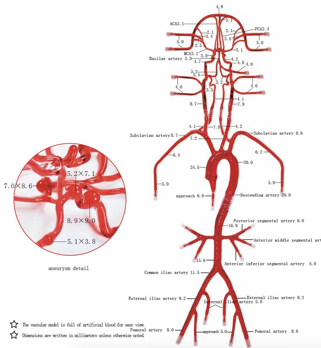 MedScan3D's tweet photo. Our Neuro Vascular System model includes: 

✅ Tortuous cerebral vasculature  
✅ Five aneurysms of different size 
✅ 3D printed based on actual CT data for physiological fidelity

Specially designed for vascular interventions training &amp; #medical device development.  #medtech https://t.co/k6kTfJRsoF