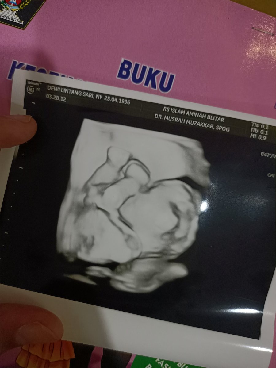 delintsa's tweet photo. sehat terus adek 🥰🥰 https://t.co/GGN5K9y7CZ