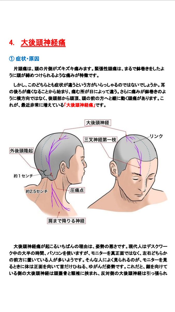 後頭 神経痛 ストレッチ