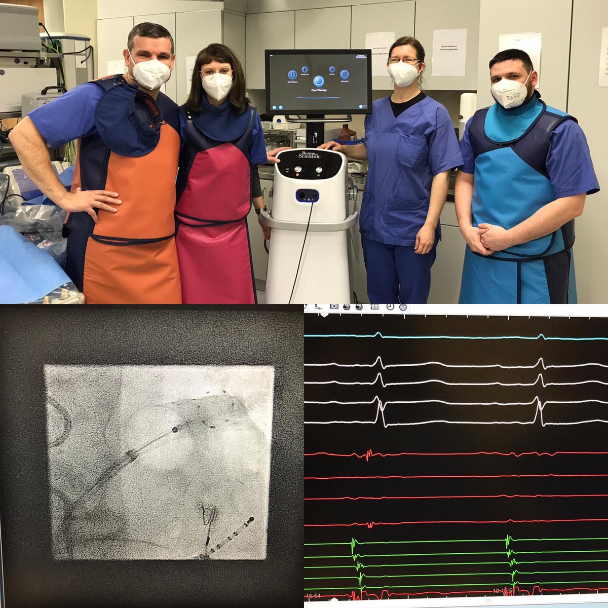Bogdan G. Muntean (@bogdangmuntean1) on Twitter photo First PolarX PVI procedures at Jewish Hospital Berlin. First impressions are that of a very effective system. Our team is looking forward to further experience with the PolarX system. Thanks to <a href="/BSC_EU_Heart/">Boston Scientific EMEA - Cardiology</a> <a href="/BSCCardiology/">BostonSci Cardiology</a> First PolarX PVI procedures at Jewish Hospital Berlin. First impressions are that of a very effective system. Our team is looking forward to further experience with the PolarX system. Thanks to <a href="/BSC_EU_Heart/">Boston Scientific EMEA - Cardiology</a> <a href="/BSCCardiology/">BostonSci Cardiology</a>