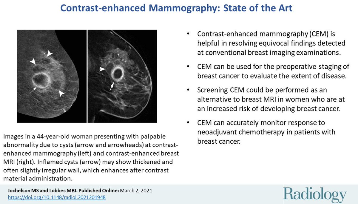 RADIOLOGY State of Art review:  points to know about contrast-enhanced mammography.  pubs.rsna.org/doi/10.1148/ra… <a href="/radiology_rsna/">Radiology</a>