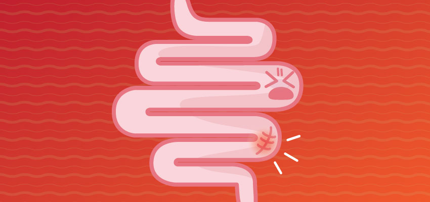 mfldclinic's tweet image. #ColonPolyps are not cancer, but the first sign that #coloncancer may be developing. Learn more → ow.ly/4VOL50DNMx2 #cancerprevention #ColorectalCancerAwarenessMonth