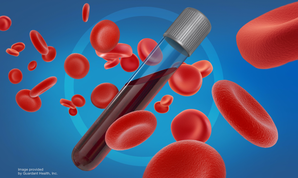 GuardantHealth's tweet photo. We're proud to announce that our Guardant360 CDx #liquidbiopsy test has received the #CEmark for comprehensive tumor mutation profiling across all solid cancers. https://t.co/owIPoM3bX3 https://t.co/CuvnzOvXhJ