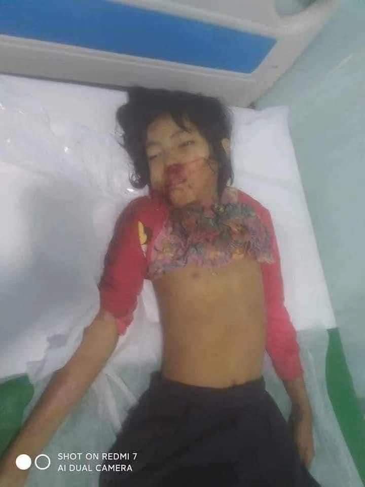 alwaysbinic's tweet photo. Tw// Blood; Mandalay 58/107 street A car without license plate knocked down 3 civilians. 2 of them were children and one was pronouced dead in GrandMdy Hospital. State -Sponsored- Terrorism #WhatsHapppeningInMyanmar #Mar2Coup @UN_HRC @YourAnonCentral @hrw @PentagonPresSec @UN https://t.co/ANhl8Ebbqg