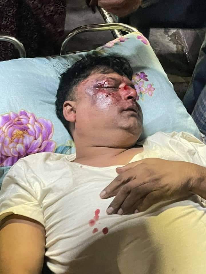 alwaysbinic's tweet photo. Tw// Blood ; Myanmar Military Terrorists vandalizing civilians' private properties at 9 pm in 20x80, 81 street, Mandalay. A man was attacked with steel bats. They continued firing bullets, slingshots and throwing sound bombs for 30 mins.  #WhatsHapppeningInMyanmar #Mar2Coup @hrw https://t.co/CulVWaG33K