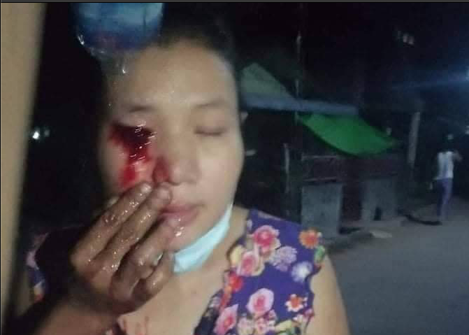 #March2Coup Kayin State. Happening this evening. Rubber bullet or slingshot.  

#WhatsHappeninglnMyanmar