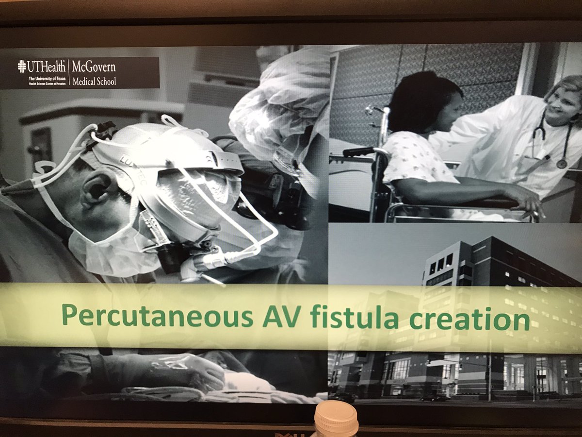 Ahmed Kamel MD, PhD, FSIR (@ahmed_kamel_ir) on Twitter photo Presenting at Noon conference (CST) to the <a href="/UTKidney/">UTHealth Houston Kidney</a> on percutaneous creation of dialysis AVF <a href="/UTHradiology/">UTHealth Houston Radiology</a> <a href="/HCIRad/">Houston Combined IR Residency</a> <a href="/UTPhysicians/">UT Physicians</a> <a href="/d_r_waguespack/">Dia Waguespack</a> <a href="/memorialhermann/">Memorial Hermann</a> <a href="/UAB_NRTC/">UAB Nephrology</a> <a href="/UTHouston_IR/">UT Houston_IR</a> <a href="/wasse_m/">Monnie Wasse, MD, MPH</a>. uthealth.webex.com/uthealth/j.php… Presenting at Noon conference (CST) to the <a href="/UTKidney/">UTHealth Houston Kidney</a> on percutaneous creation of dialysis AVF <a href="/UTHradiology/">UTHealth Houston Radiology</a> <a href="/HCIRad/">Houston Combined IR Residency</a> <a href="/UTPhysicians/">UT Physicians</a> <a href="/d_r_waguespack/">Dia Waguespack</a> <a href="/memorialhermann/">Memorial Hermann</a> <a href="/UAB_NRTC/">UAB Nephrology</a> <a href="/UTHouston_IR/">UT Houston_IR</a> <a href="/wasse_m/">Monnie Wasse, MD, MPH</a>. uthealth.webex.com/uthealth/j.php…