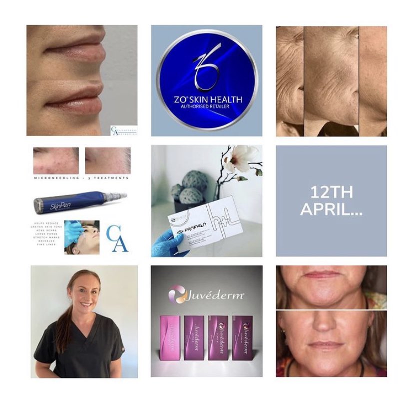 All dental appointments for existing and new patients have resumed. Facial aesthetics with Amy can resume 12th April according to the government roadmap. #wetherbyhour #york_place_dental #wetherbydentist