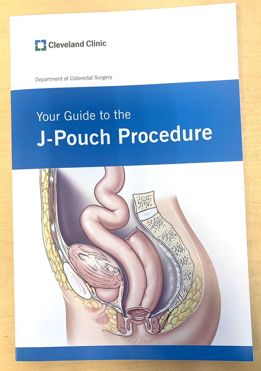 HolubarStefan's tweet photo. Hot off the press a new #IPAA #jpouch book for the 21st-century! A labor of love ❤️ from @drtracyhull @AmyLightnerMD @ScottRSteeleMD @JeremyLipman and many others..... @ClevelandClinic @CleClinicMD #SoMeIBD #SoMe4Surgery #GlobalSurgery #IBD #IBDPartner @CCfdnNEOhio https://t.co/svljGGwi2z