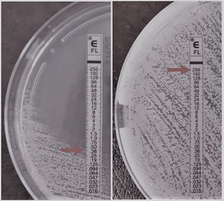 When a single SNP, introduced in one of the 5800 genes of Candida parapsilosis, is enough to confer high level resistance to fluconazole. Amazing ! Thanks CRISPR-Cas9 :) 🙏
#antifungalresistance #CRISPR