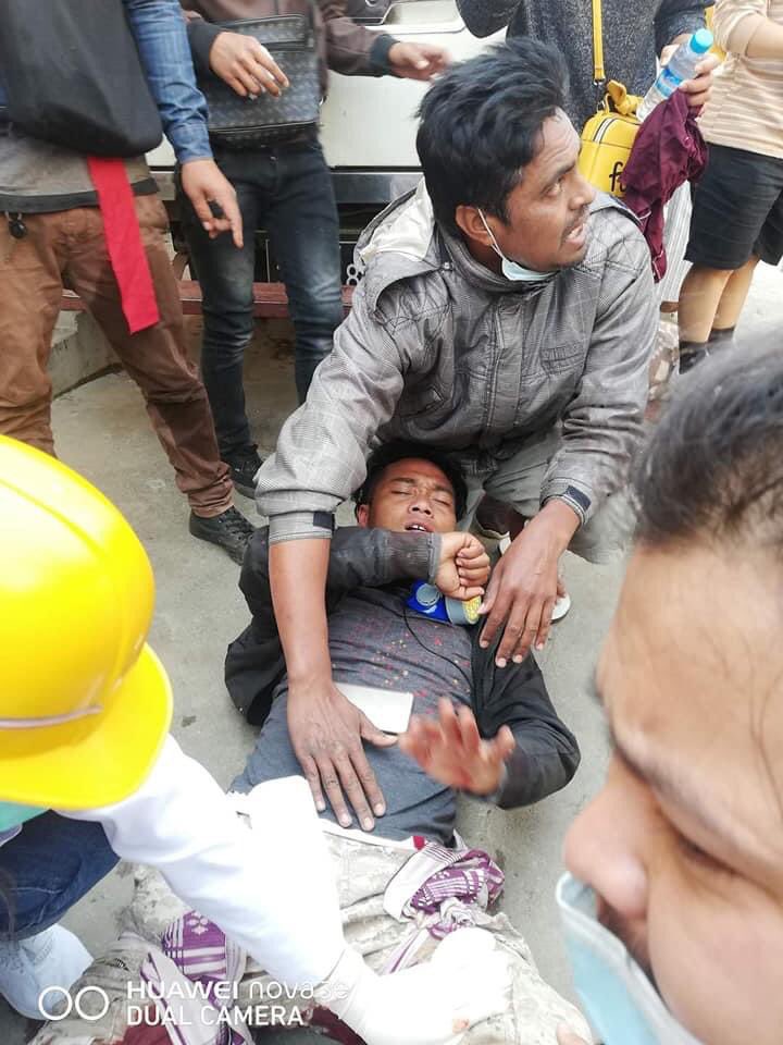 xumeiling23's tweet photo. Tw //blood Another violent crackdown happening in PyinOoLwin. The bullet went through one protester's thigh. JUSTICE FOR MYANAMR #WhatsHappeningInMyanmar #Mar3Coup @freya_cole https://t.co/nXQfdsWNt9