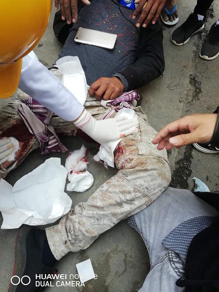 xumeiling23's tweet photo. Tw //blood Another violent crackdown happening in PyinOoLwin. The bullet went through one protester's thigh. JUSTICE FOR MYANAMR #WhatsHappeningInMyanmar #Mar3Coup @freya_cole https://t.co/nXQfdsWNt9