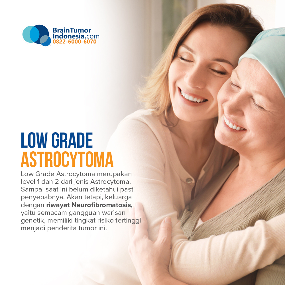 Low Grade Astrocyoma sendiri bisa dibagi menjadi 3 tipe, yaitu Pilotyc Astrocytoma, Pleomorphic Xantroastrocytoma, dan Astrocytoma tersebar.
Temukan informasi selengkapnya di BrainTumorIndonesia.com 
#healthcare #brain #kesehatan