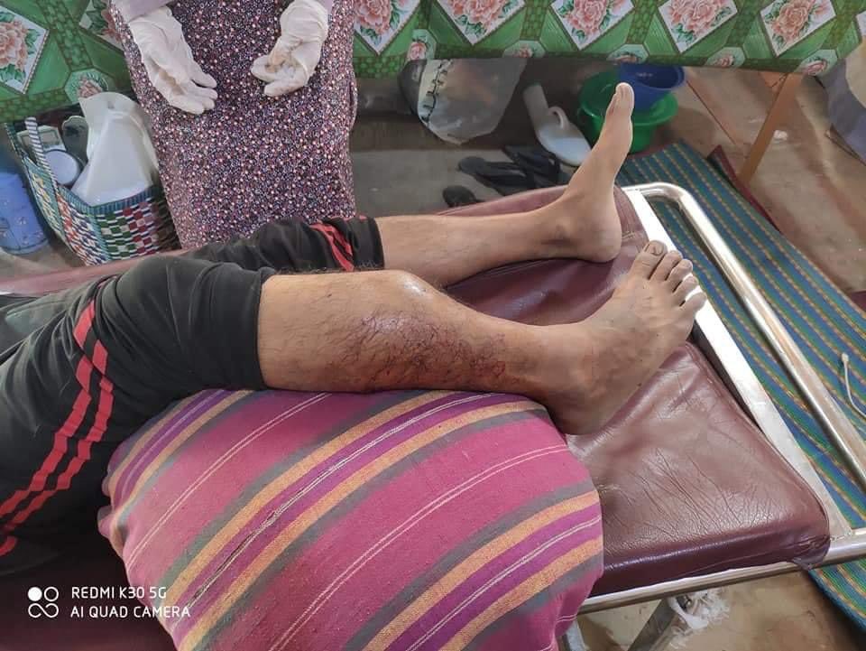 hannayuri_twt's tweet photo. TW//Blood,Gunshots
Red Code Myingyan 🚨

Ten people were injured in a violent crackdown on  protesters in Myingyan Township, Mandalay Region, around 10 am to till now Military Juntas still violet with Tear gas and Guns. 

@YourAnonCentral 

 #WhatsHappeningInMyanmar
#Mar3Coup https://t.co/sCdl5nvGik