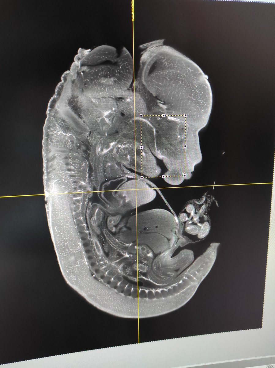DeeMKav's tweet image. Almost one year after closure it is so good to see this project back up and running 🥰 @COMPARE_UoBUoN @wattack #lightsheet #microscopy