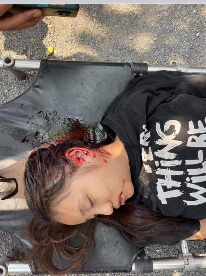 Than Sic Aung TW // Blood, Death

Kyal Sin, age 19, a female protester against the military coup, was just pronounced dead in Mandalay. A man was killed during the crackdown too. Source confirmed with family members. 😭

JUSTICE FOR MYANMAR 
#WhatsHappeningInMyanmar #Mar3Coup