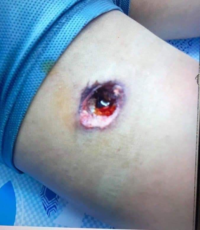 alwaysbinic's tweet photo. Tw//blood; A passerby in Oakkyin,Yangon was severely injured by military terrorists Cheddite bullets. They detained him for 2 days without medical treatment.  @UN_HRC @hrw  @UN @NATO @KenRoth @RapporteurUn @freya_cole

JUSTICE FOR MYANMAR

#Mar3Coup
#WhatsHappeningInMyanmar https://t.co/E9NQNyqDSA